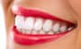 General-Dental-services-American-Dental-Care