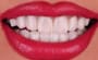 Smile Design