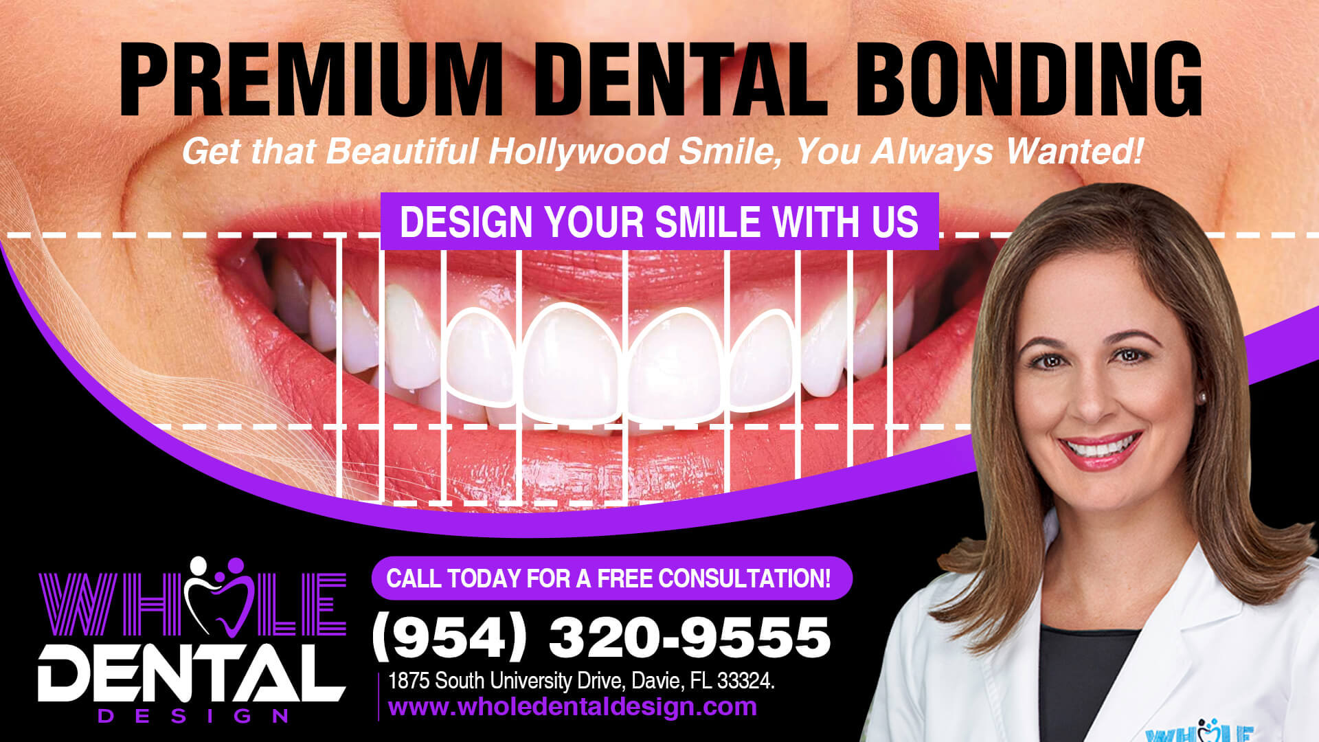 Tooth Bonding | Cavities Specialist in Davie | Plantation, FL