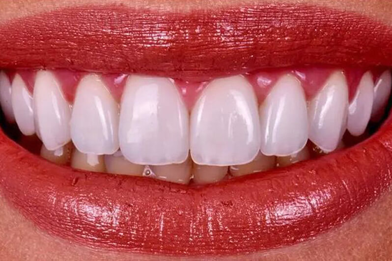 Whole Dental Whole Dental