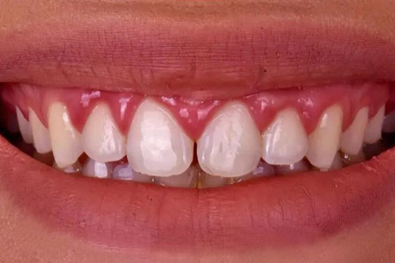 Whole Dental Whole Dental