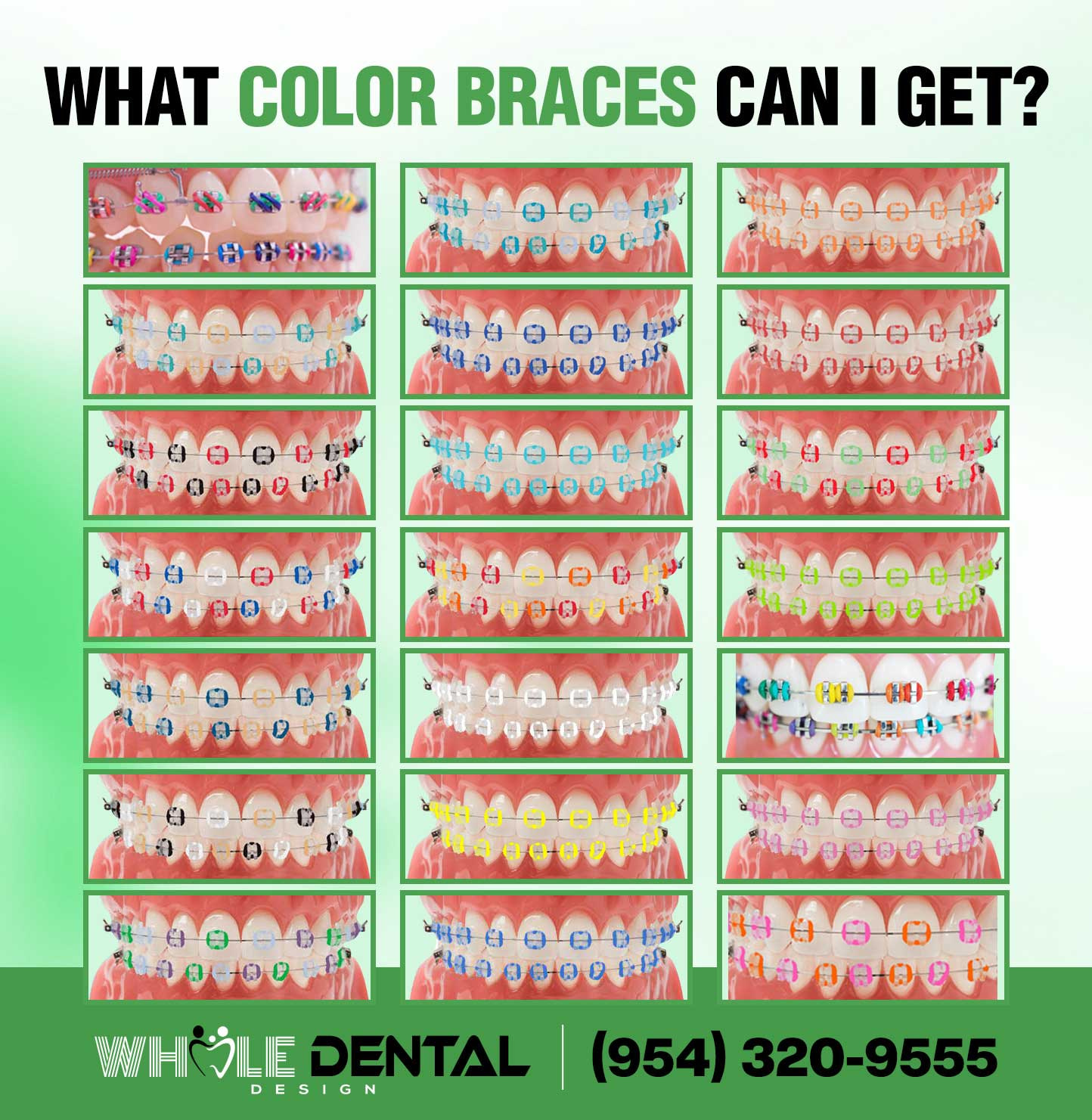 Dental-Braces-HD-Image2