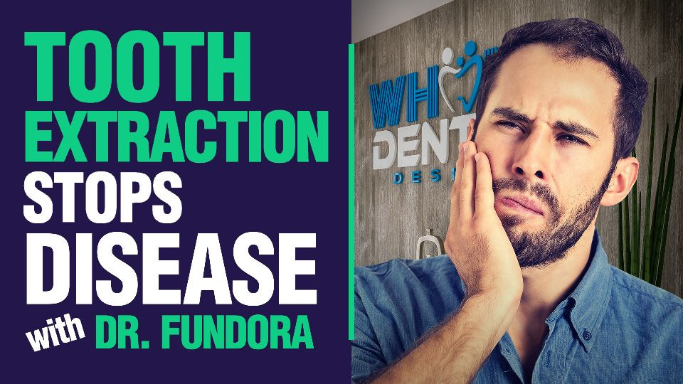 Tooth-Extraction
