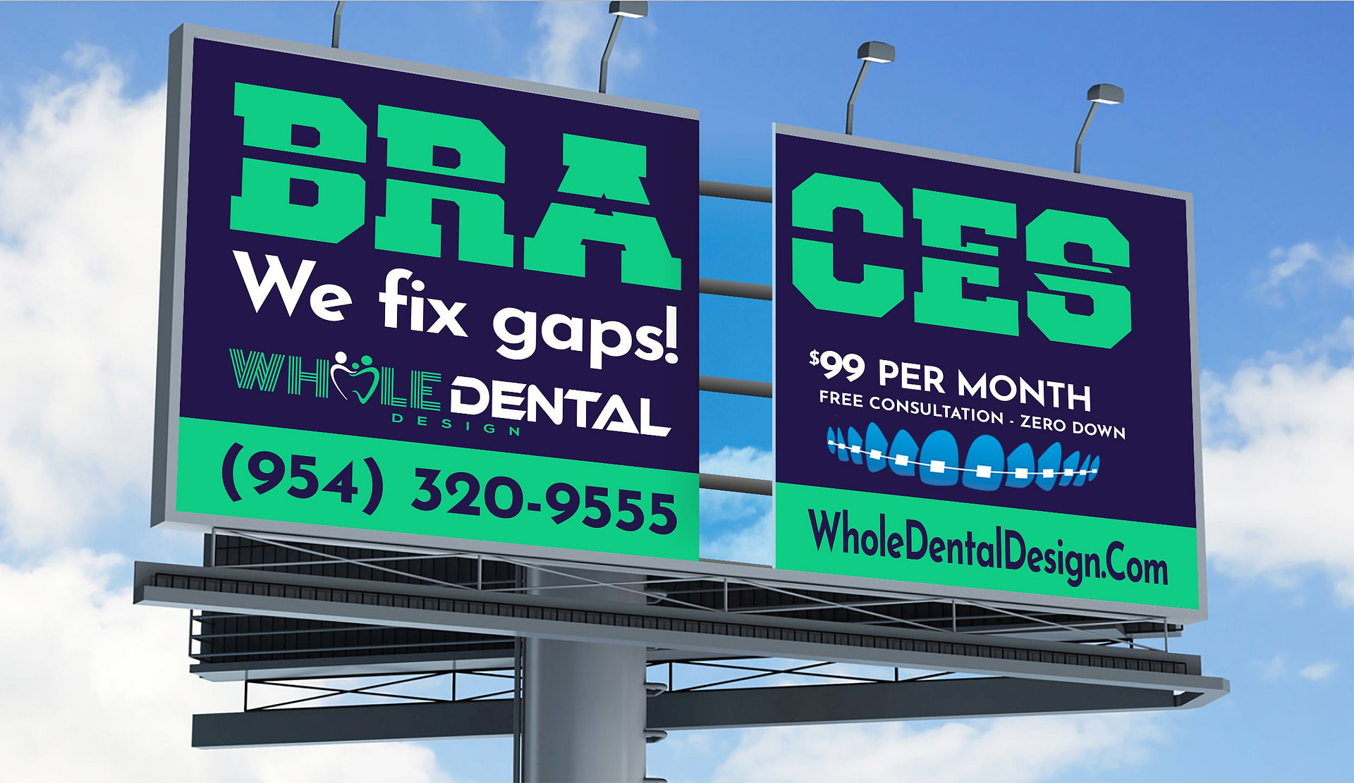 Braces Special Billboard